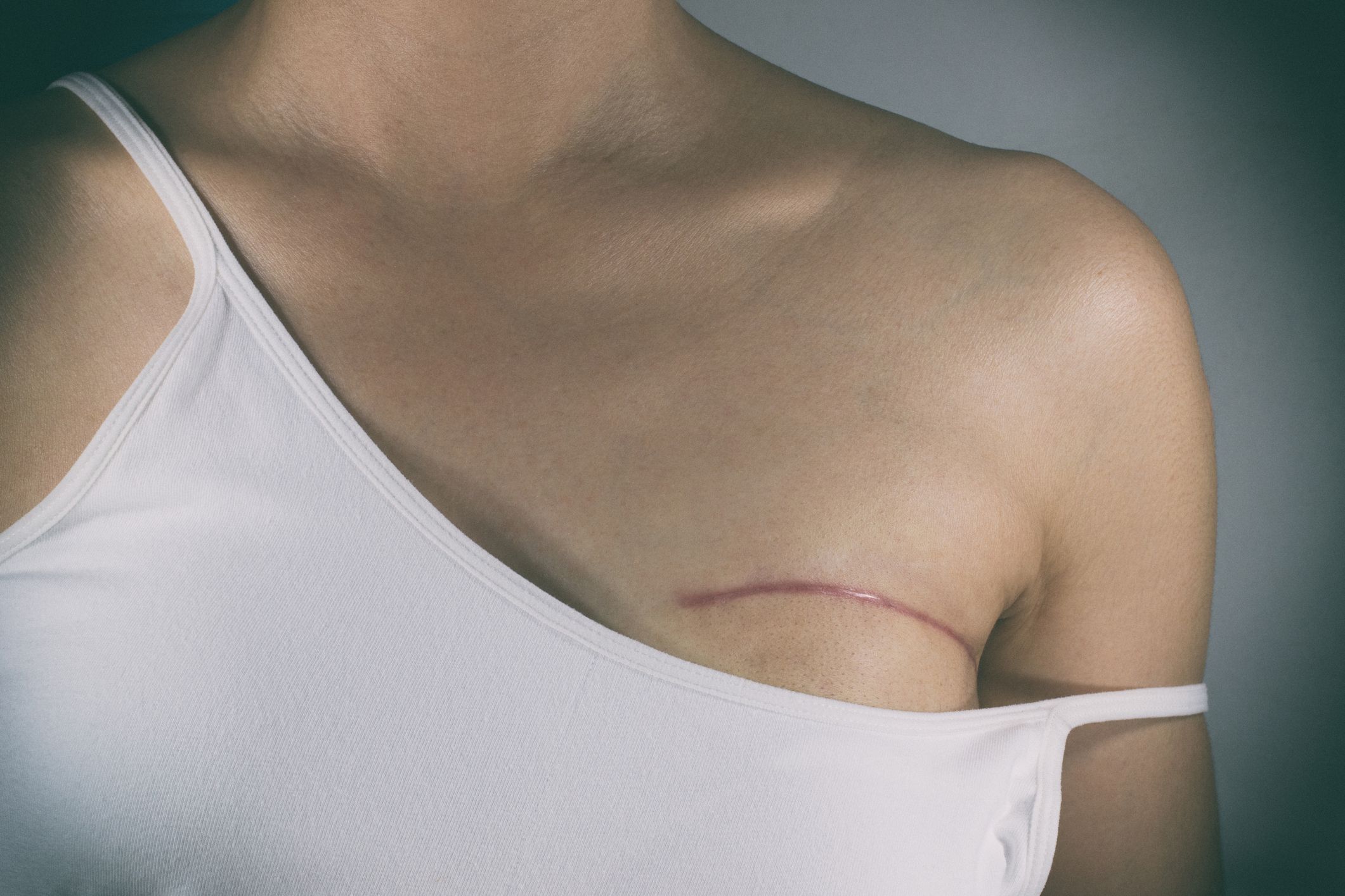 Why Should You Consider Breast Reconstruction Surgery? Why Should You Consider Breast Reconstruction Surgery?