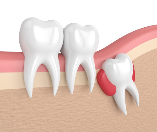 Choosing Wisely: Qualifications to Seek in an Emergency Dentist Choosing Wisely: Qualifications to Seek in an Emergency Dentist